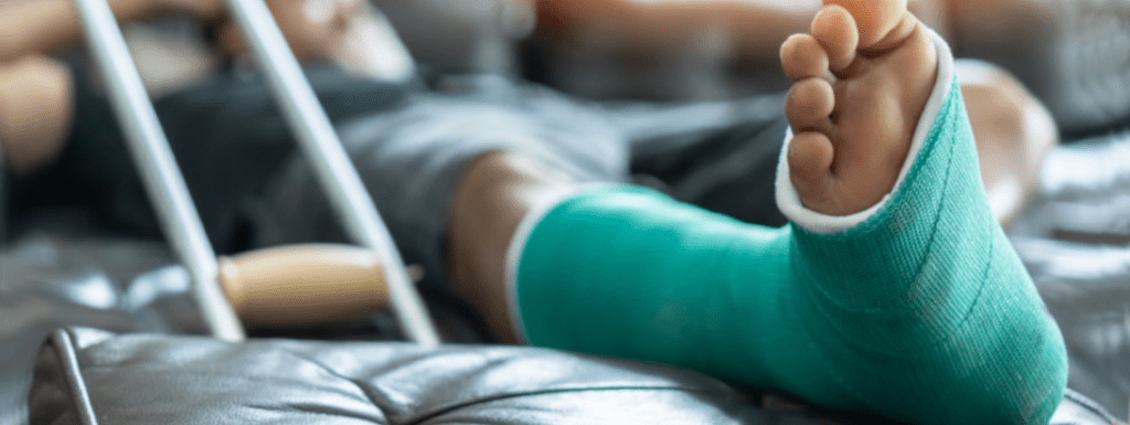 A broken foot