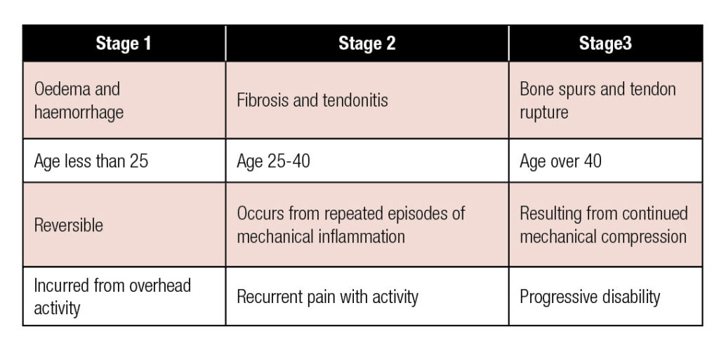 subacromial impingement