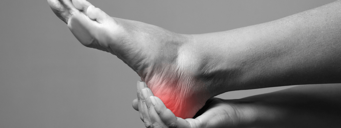 Got heel pain? It may not be plantar fasciitis