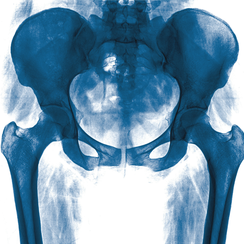 Image for Pelvic Balance Workshop