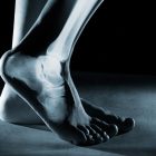 Foot and ankle pain - Image of human foot ankle and leg in x-ray, on gray background