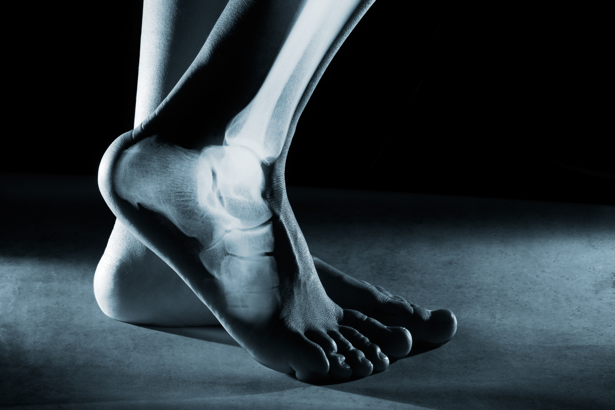 Assessing and correcting foot and ankle pain