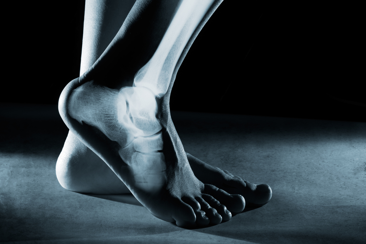 Assessing and correcting foot and ankle pain FitPro Blog